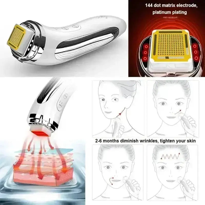 Appareil de lifting du visage par radiofréquence RF Bantout.prod