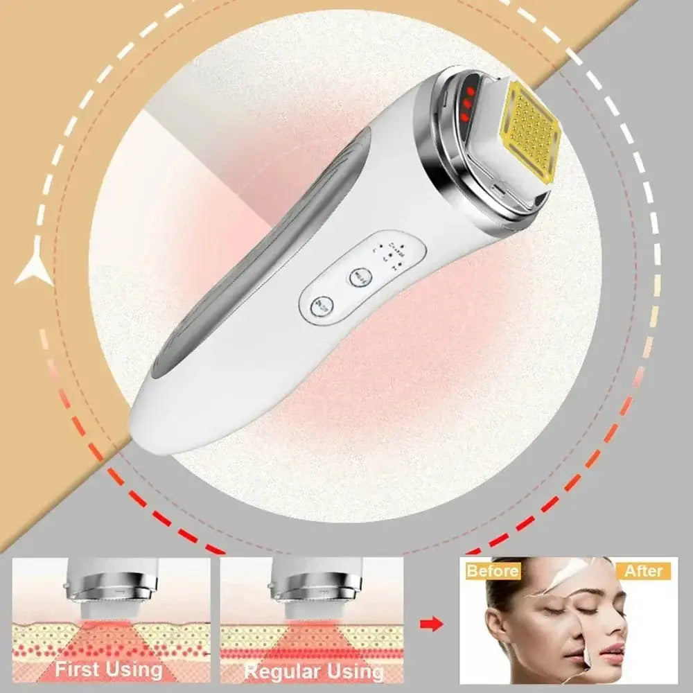 Appareil de lifting du visage par radiofréquence RF Bantout.prod