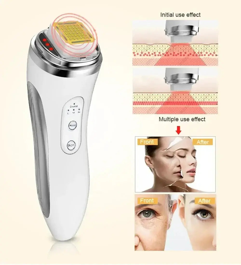 Appareil de lifting du visage par radiofréquence RF Bantout.prod