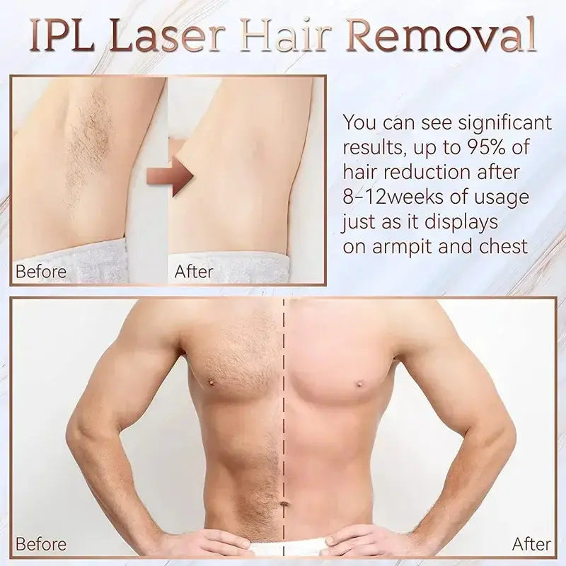 Épilateur laser permanent à 999 999 flashs pour bikini, appareil d&