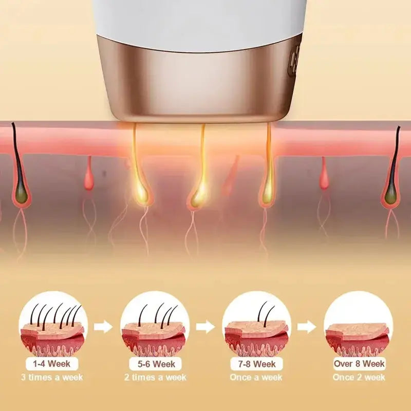 Épilateur laser permanent à 999 999 flashs pour bikini, appareil d&