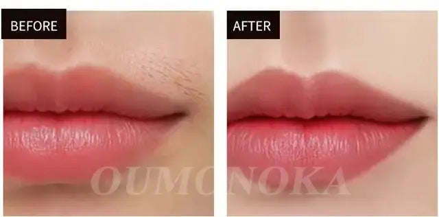 Épilateur laser permanent à 999 999 flashs pour bikini, appareil d&