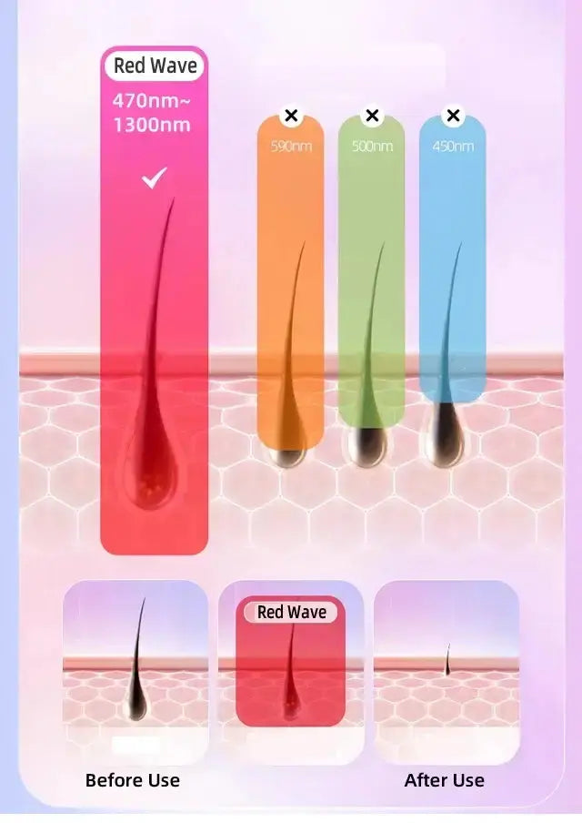 Épilateur laser permanent à 999 999 flashs pour bikini, appareil d&