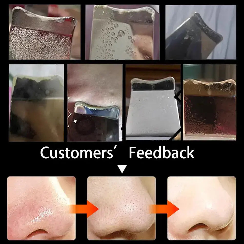 Customer feedback on electrical skin cleanser showcasing before and after results for blackhead removal.