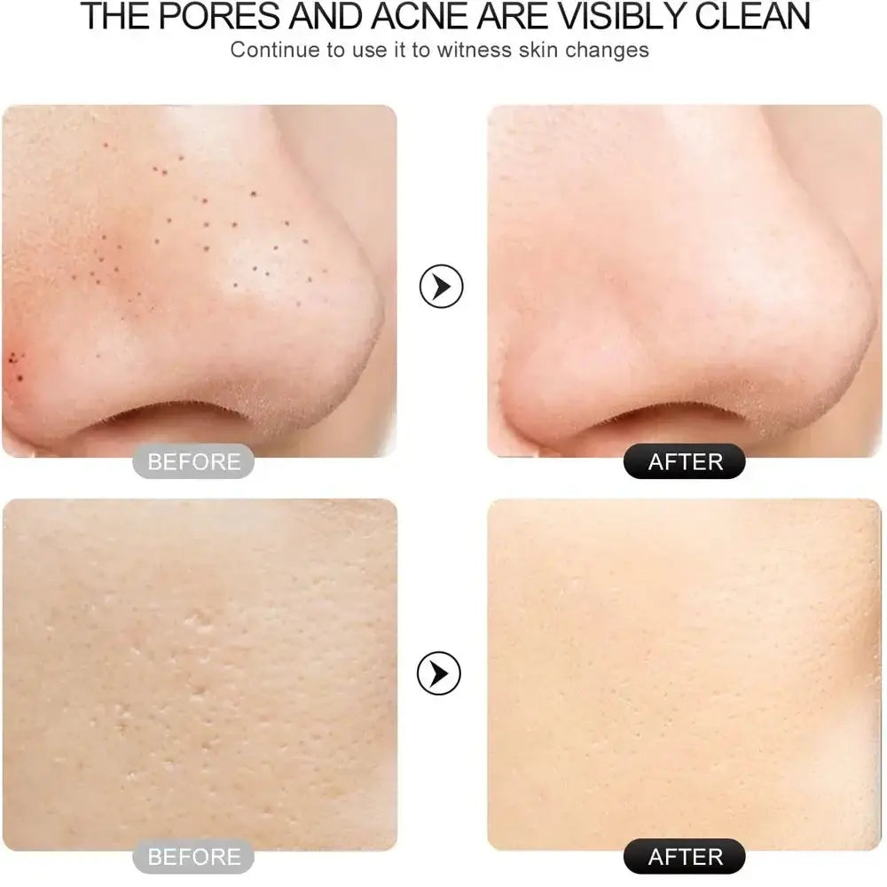 Comparative image showing visible skin improvement before and after using an electric skin exfoliator.