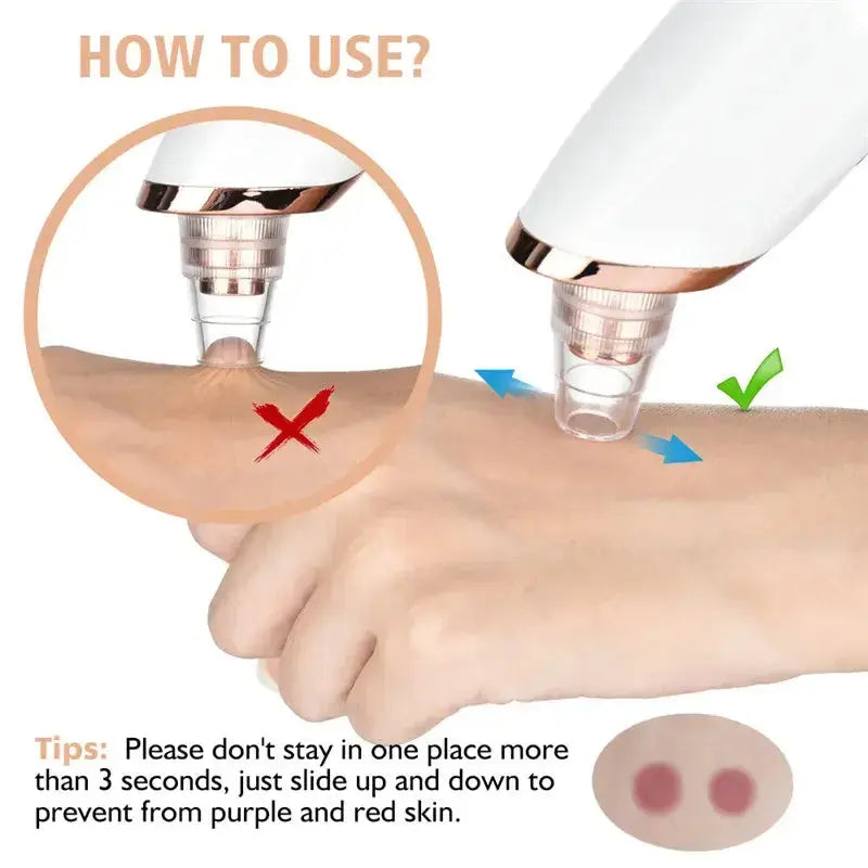 Instructions for using the USB rechargeable blackhead extractor on skin, demonstrating suction technique.
