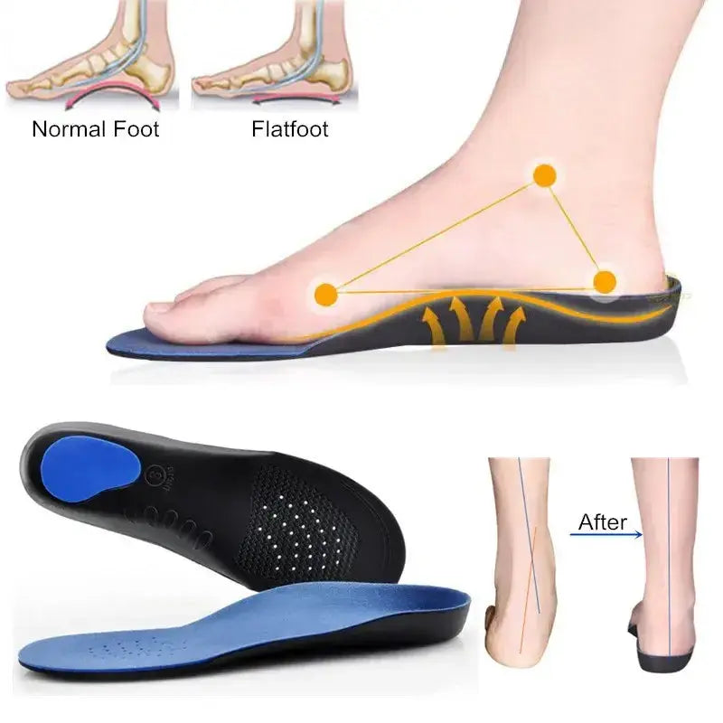 Orthotic Gel High Arch Support Insoles Gel Pad EVA Arch Support Flat Feet For Women / Men orthopedic Foot pain Unisex - Bantout.prod