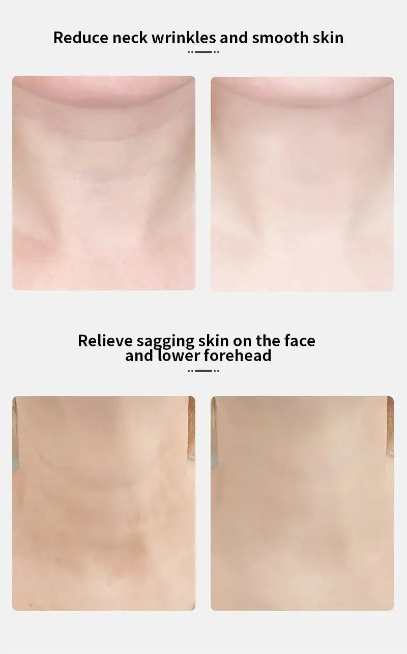 Soin de la peau Raffermissement de la peau Réduction du double menton Bantout.prod