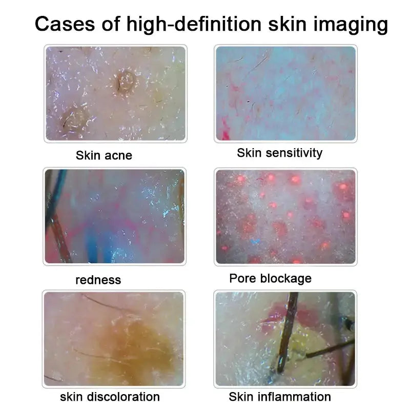 Analyseur de peau numérique HD Détecteur professionnel de caméra de cuir chevelu Appareil de test d&