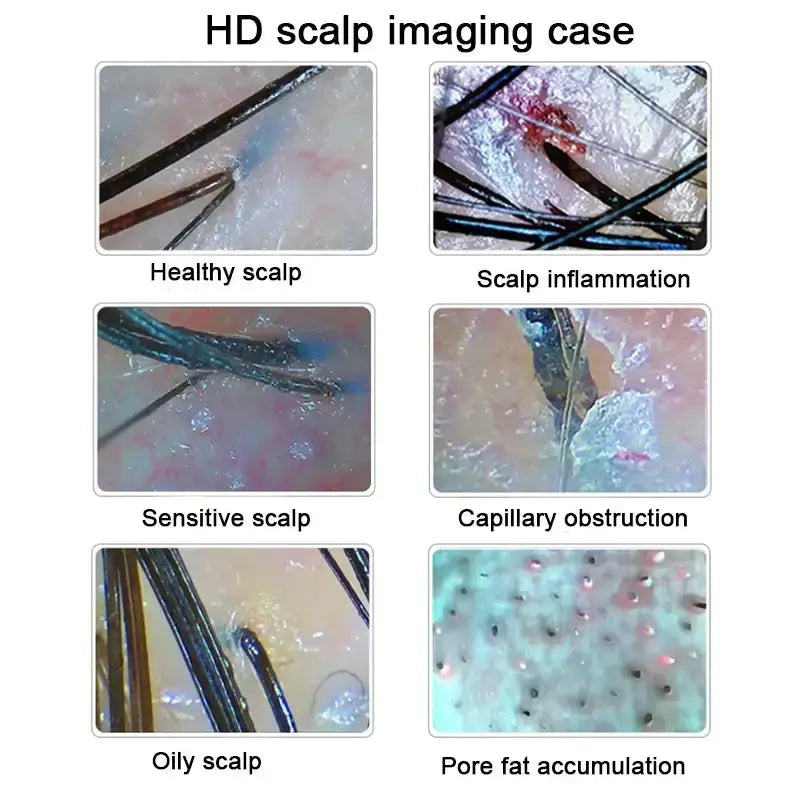 Analyseur de peau numérique HD Détecteur professionnel de caméra de cuir chevelu Appareil de test d&