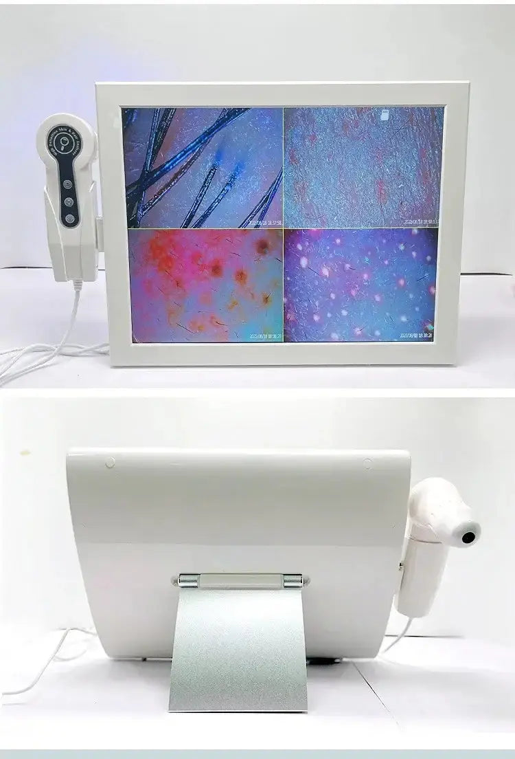 Analyseur de peau numérique HD Détecteur professionnel de caméra de cuir chevelu Appareil de test d&