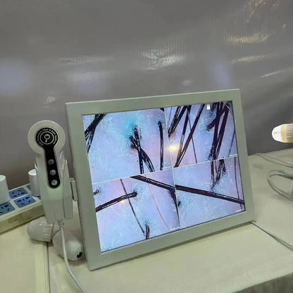 Analyseur de peau numérique HD Détecteur professionnel de caméra de cuir chevelu Appareil de test d&