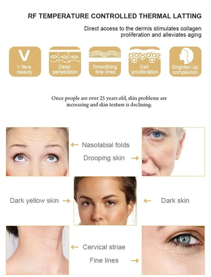 Appareil de lifting du visage par radiofréquence RF Bantout.prod