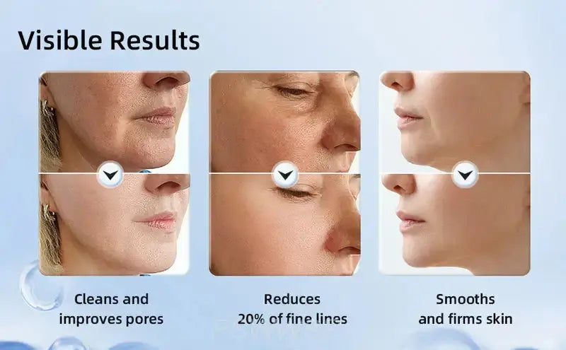 Appareil de massage facial pour le cou et le visage, outil de soins de la peau, lifting et raffermissement Bantout.prod
