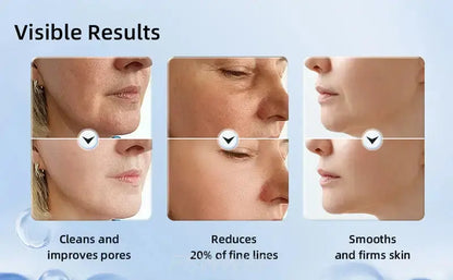 Appareil de massage facial pour le cou et le visage, outil de soins de la peau, lifting et raffermissement Bantout.prod