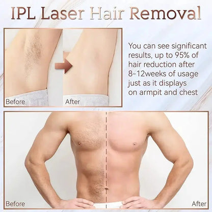 Épilateur laser permanent à 999 999 flashs pour bikini, appareil d&