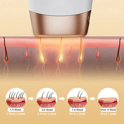 Épilateur laser permanent à 999 999 flashs pour bikini, appareil d&