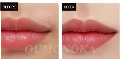 Épilateur laser permanent à 999 999 flashs pour bikini, appareil d&