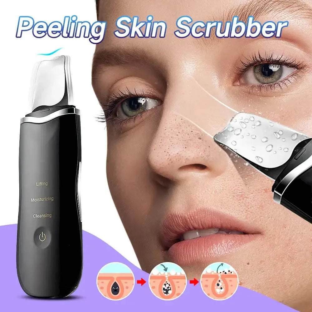 Electric peeling skin scrubber for blackhead removal and facial cleansing with vibration technology.
