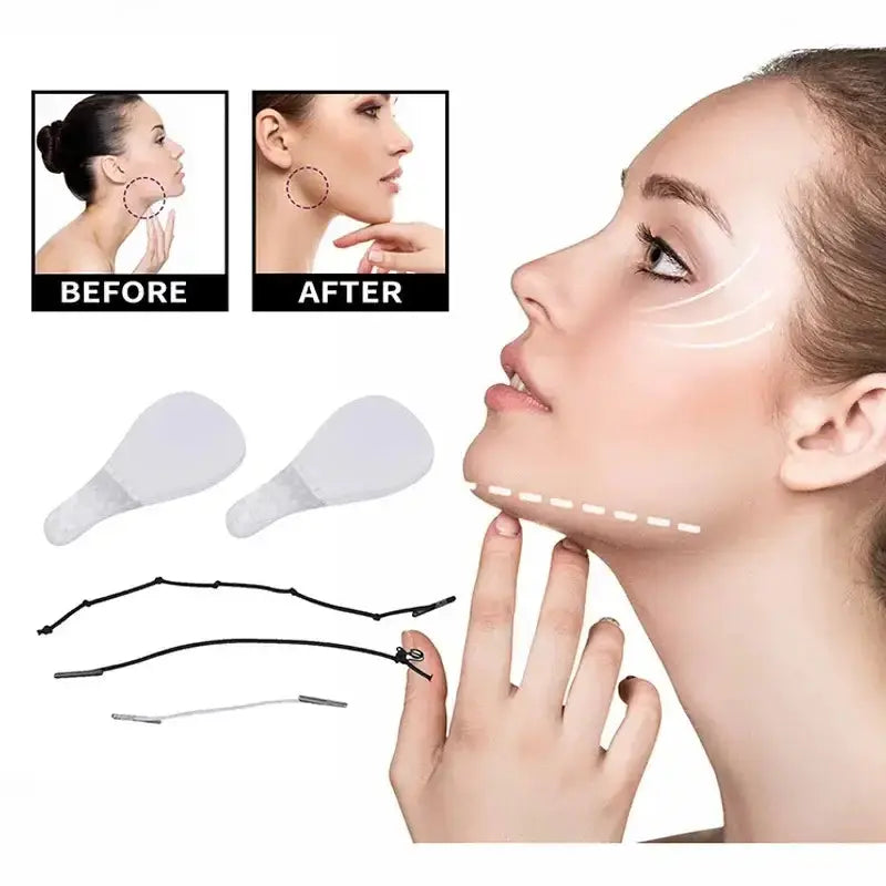 Before and after image showing facial lifting results with DEDOMON invisible lifting patches.