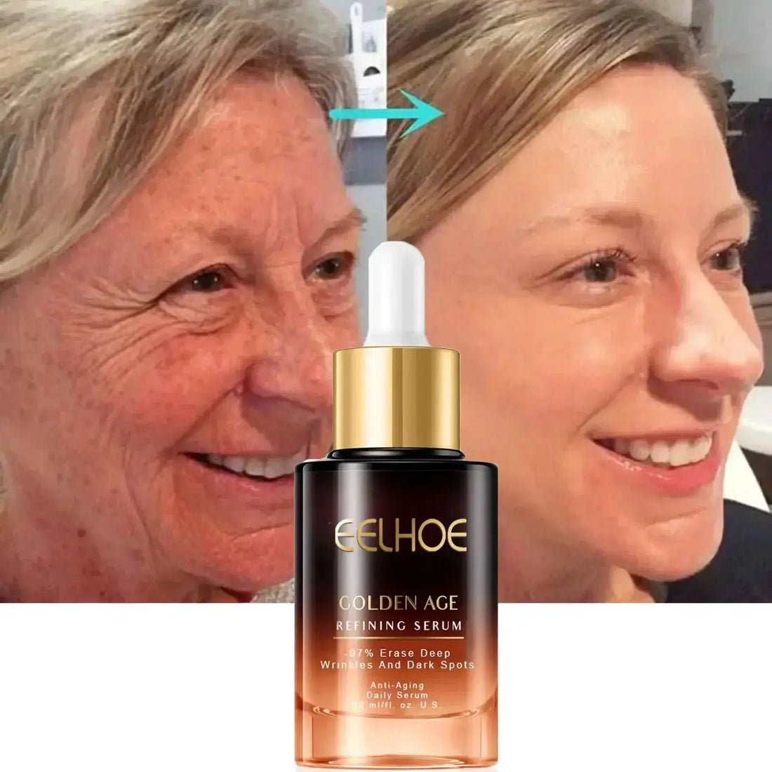 Eelhoe Golden Age Refining Serum visibly reduces wrinkles and dark spots for a youthful complexion.