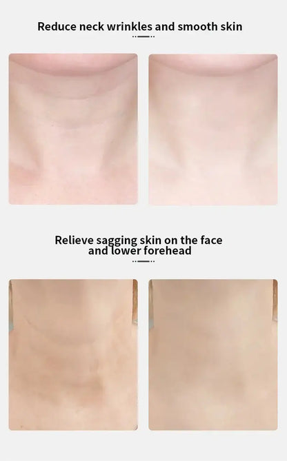 Soin de la peau Raffermissement de la peau Réduction du double menton Bantout.prod